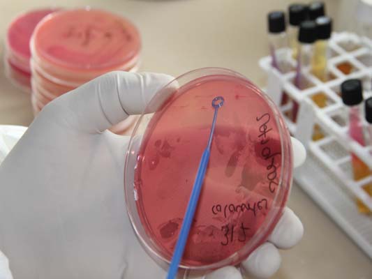 Streaking of Sample on the media for purpose of organism growth